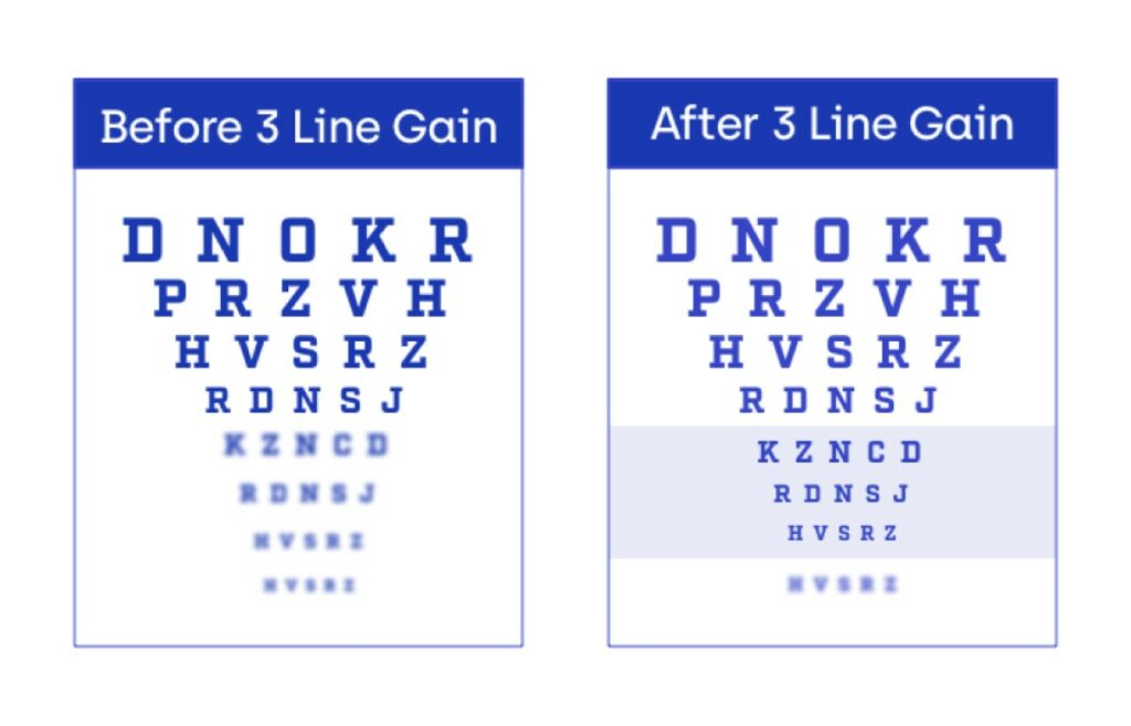 Eye Chart